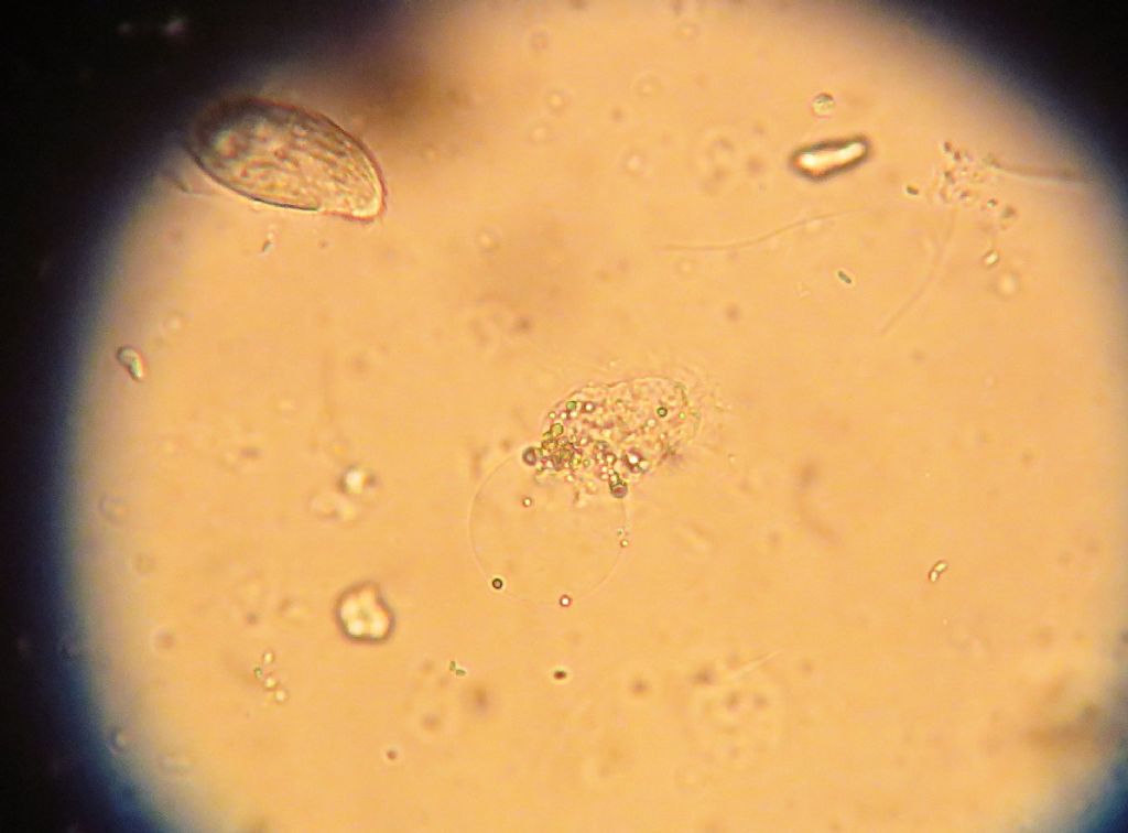 Amoeba ID